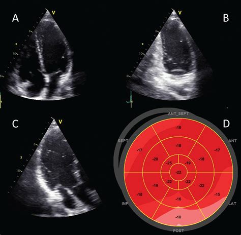 normal left ventricular systolic function